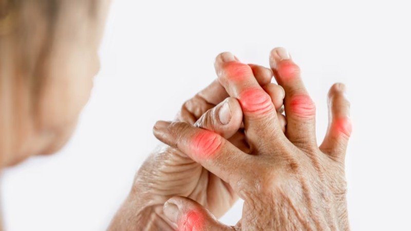 Calcium Deficiency: Symptoms, Causes And Treatment