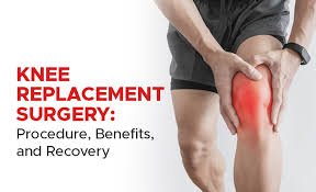 Knee Replacement Surgery: Procedure, Indications And Recovery